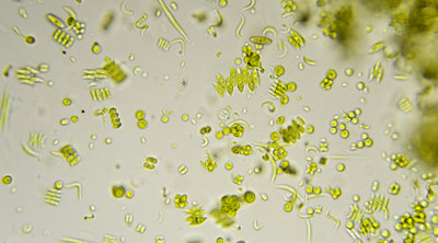 Plant-based omega-3 DHA supplement from algae oil