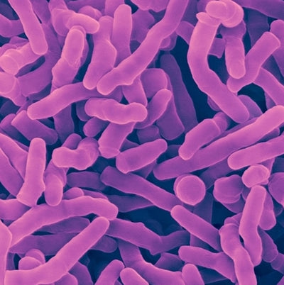 Propionibacterium freudenreichii: benefici dei batteri propionici